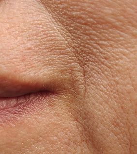 image close up of dehydration and dryness